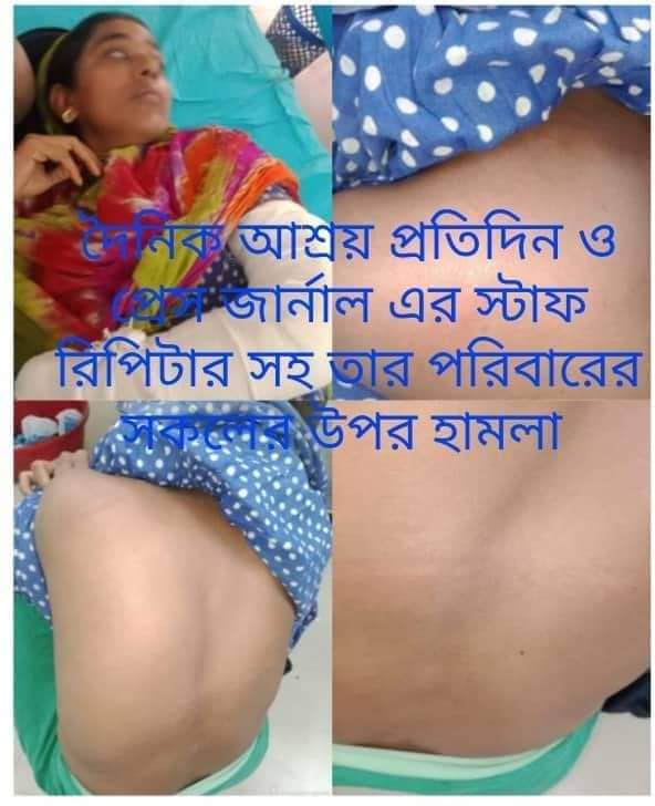 দৈনিক আশ্রয় প্রতিদিন লাকসাম নরপাটি আদর্শ গ্রামে সাংবাদিকসহ স্ব-পরিবারের সবার উপরে হামলা