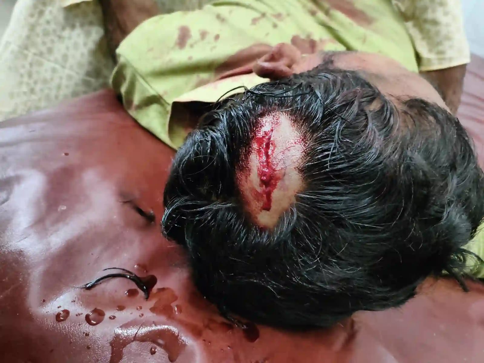 পাংশায় ইফতারের সময় কথা কাটাকাটির জের ধরে হামলার ঘটনায় থানায় মামলা